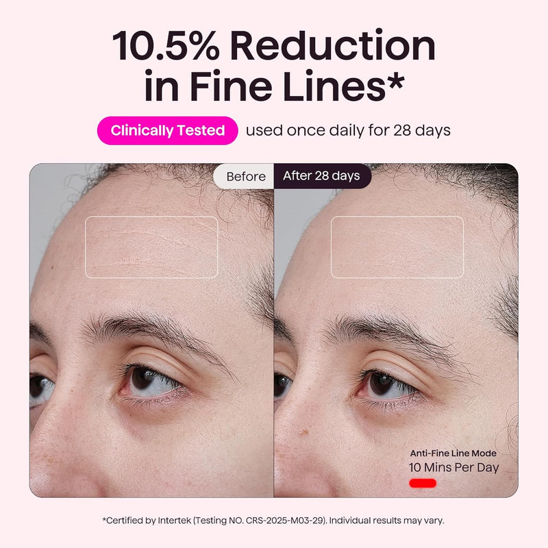 Wavytalk Glow Time - Mascara LED Facial, Terapia de Luz Roja, Azul y Ambar para Anti-Acne y Rejuvenecimiento