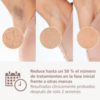 Philips Lumea Serie 9900 IPL - Depiladora con Inteligencia Artificial y 4 Accesorios