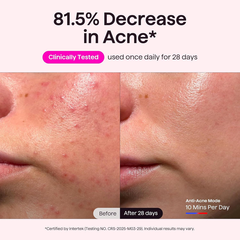 Wavytalk Glow Time - Mascara LED Facial, Terapia de Luz Roja, Azul y Ambar para Anti-Acne y Rejuvenecimiento