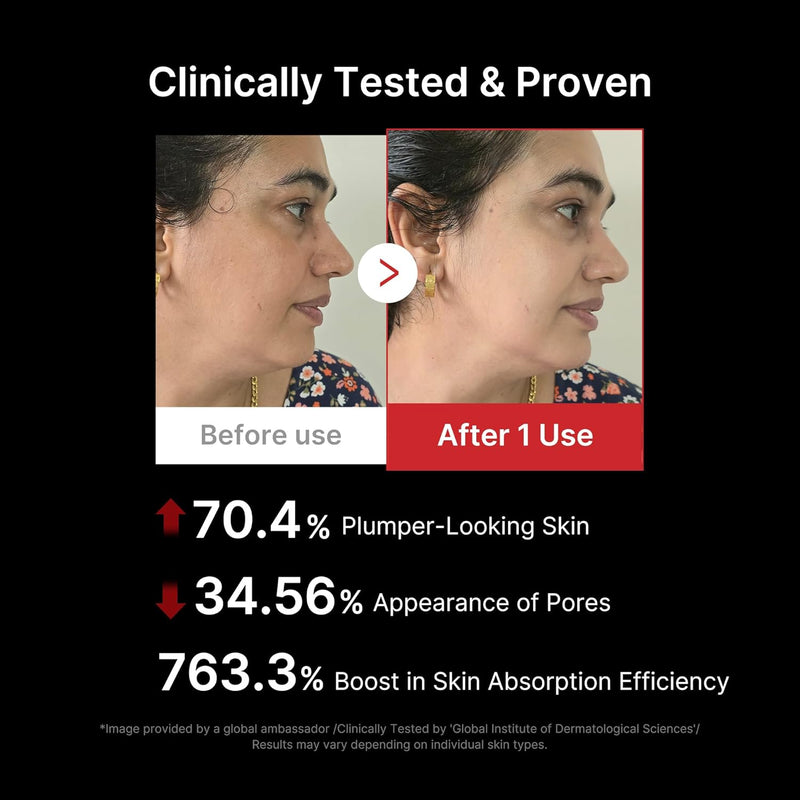 Medicube Age-R Booster Pro - Dispositivo Coreano 6 en 1, Glass Skin, EMS, LED, Masajeador Facial
