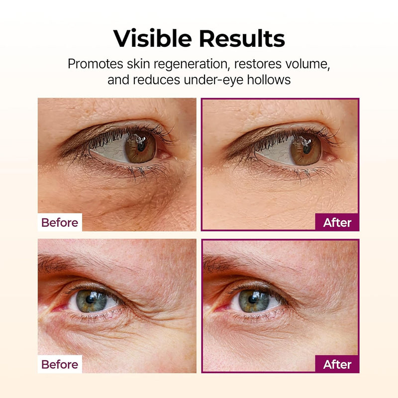 Dr.Melaxin Cemenrete Balsamo Multifuncional de Calcio y Colageno 9g, Tratamiento Antiarrugas para Rostro y Contorno de Ojos, Stick Coreano