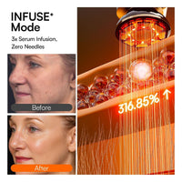 INIA Flare - Marfil