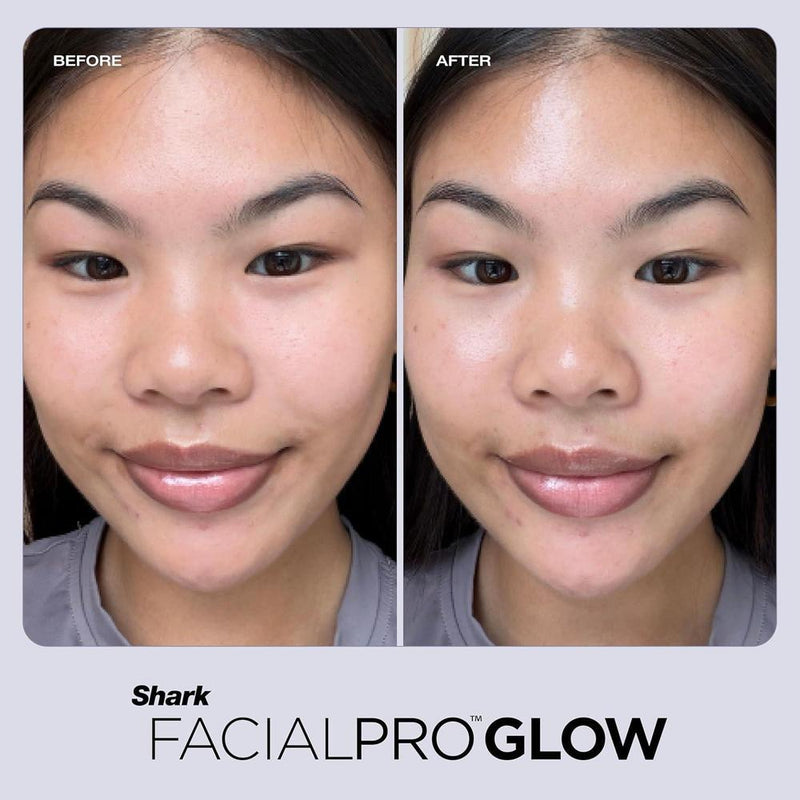 Shark FacialPro - Fórmula Hydro Infuse