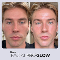 Shark FacialPro - Gel Derm Detox