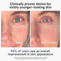 Máscara facial LED iRestore con terapia de luz roja, azul e infrarroja. Rejuvenece la piel y reduce arrugas, líneas finas y manchas oscuras