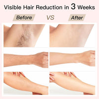 Depilación IPL Bosidin Con Enfriamiento De Hielo Y Rejuvenecimiento Facial SR