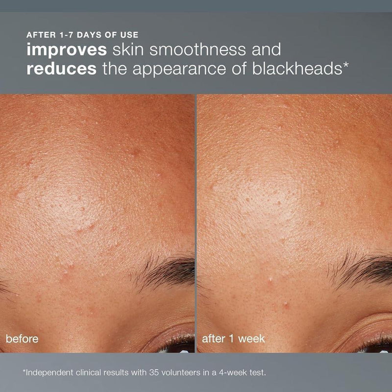 Dermalogica Exfoliante Facial Polvo Con Ácido Salicílico Y Papaya 13g