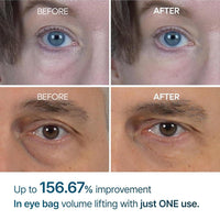 Crema para Bolsas de Ojos Dr.Melaxin Eyephalt, reducción de hinchazón y ojeras, mejora la elasticidad con EGF y Bio-Spicule