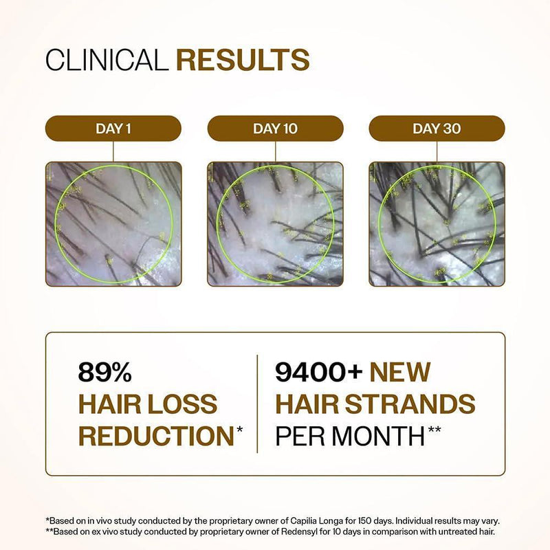 Bare Anatomy Suero Capilar Avanzado con Redensyl, Anagain, Baicapil y Capilia Longa para Caída del Cabello