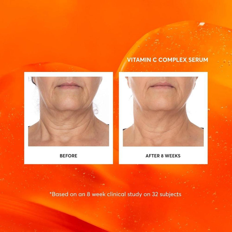 Naturium Suero Facial Complejo De Vitamina C Antienvejecimiento 30ml