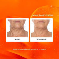 Naturium Suero Facial Complejo De Vitamina C Antienvejecimiento 30ml