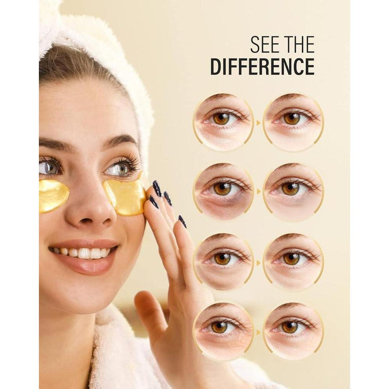 24k Gold Under Eye Patches, Alivian Hinchazón Y Ojeras Con Colágeno, 50 Pares