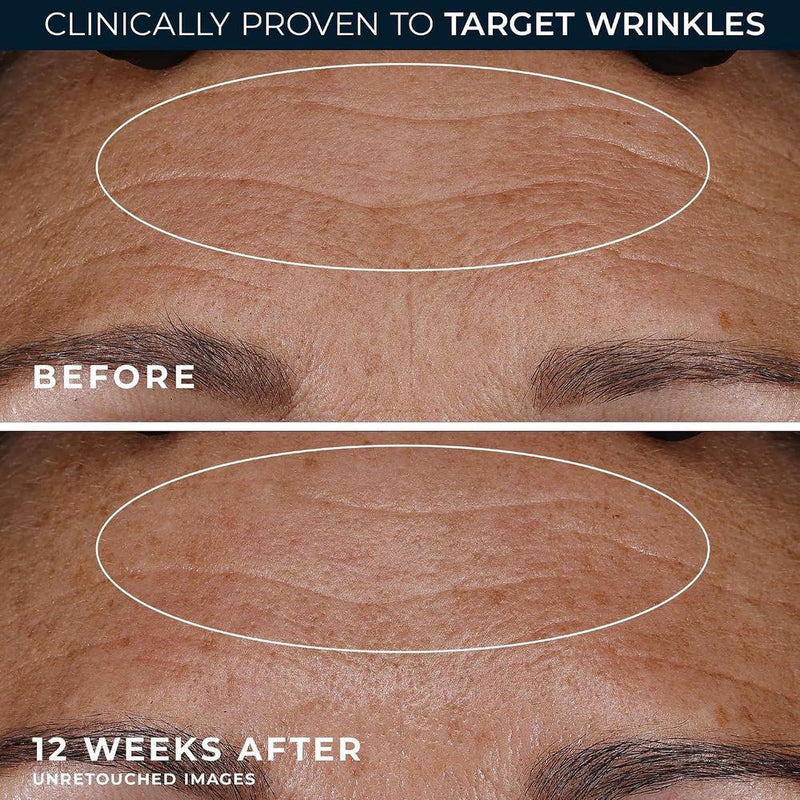 Roc Retinol Correxion Deep Wrinkle Night Cream 30ml