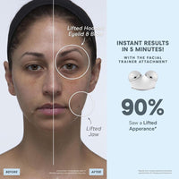 NuFACE Trinity+ Dispositivo Facial de Microcorriente Aprobado por la FDA - Esculpe Rostro y Tensa Cuello + Gel Activador