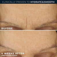 RoC Hidratante Facial Antienvejecimiento con Retinol y Ácido Hialurónico para Líneas Finas, Manchas Oscuras y Cicatrices