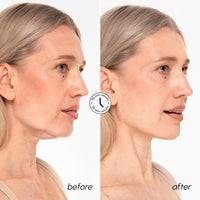 Máscara de elevación MAREE V Line con oro de 24k, colágeno profundo para mujeres, reafirma cuello y mandíbula con retinol y ácido hialurónico
