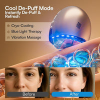 INIA masajeador facial con terapia de luz roja, térmico y cryo, tecnología 7 en 1 para el cuidado de la piel de rostro y cuello