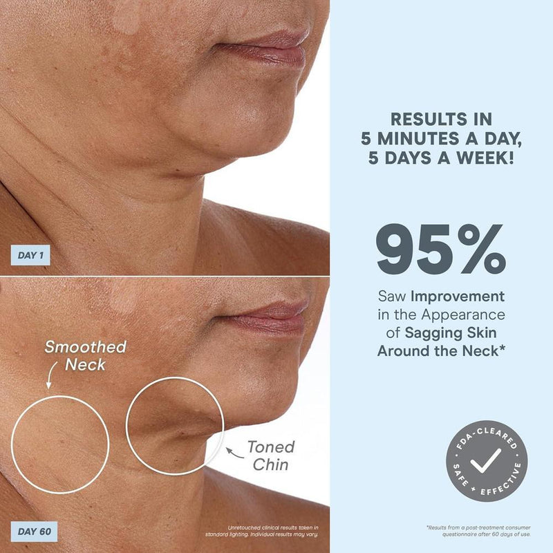 NuFACE MINI+ Kit De Dispositivo Facial De Microcorriente Para Esculpir, Levantar Y Tonificar La Piel, Aprobado Por La FDA
