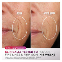 Shark CryoGlow Mascarilla LED Facial - Lila Chill